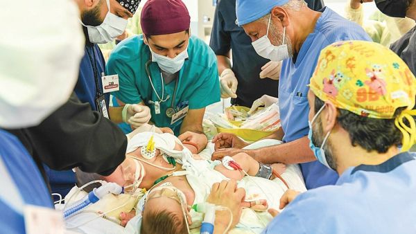 فصل التوأم اليمني مودة ورحمة 
