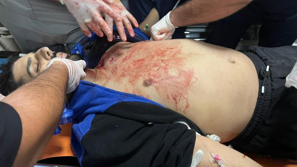 3 شهداء في نابلس