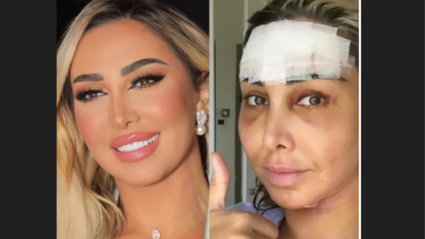 Joel Mardinian Shares Developments of Her Surgery 