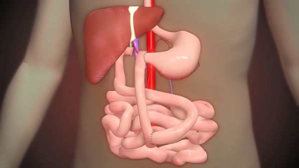 شلل الأمعاء: الأعراض، الأسباب، المضاعفات، العلاج