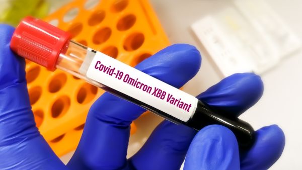 الكويت ترصد متحور "XBB.1.5" من فيروس كورونا