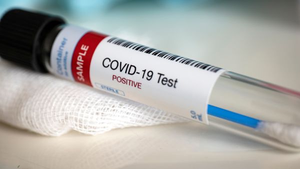 COVID-19