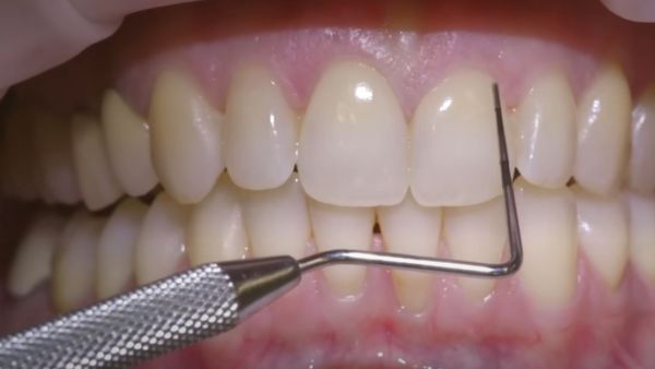 الطبيب كان يدير عيادة أسنان من قبو منزل