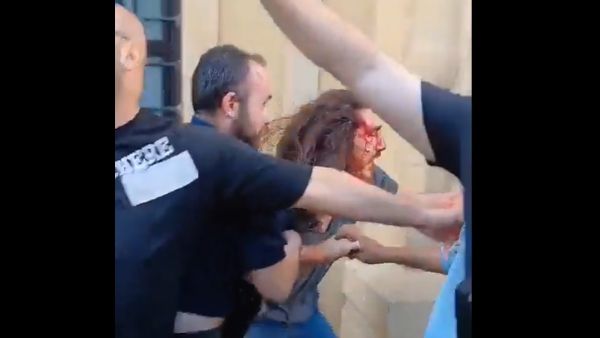 جرحى في اعتداء على مسيرة مؤيدة للمثليين في بيروت