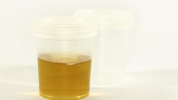 تفسير حلم البول في المنام للرجل