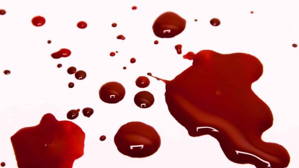 تفسير رؤية الدم في المنام يخرج من شخص آخر