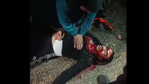 فلسطينية تحاول انعاش ابنها المصاب في جنين