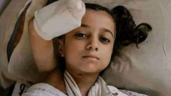 طفله فلسطينية فقدت احد اطرافها نتيجة العدوان على غزة