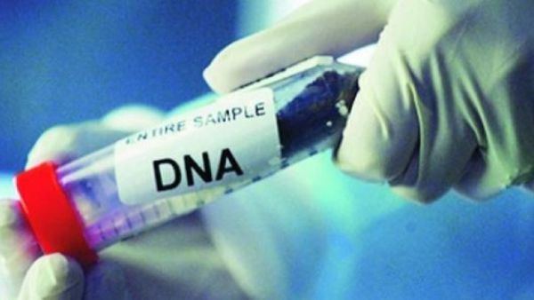 عينة فحص DNA DNA