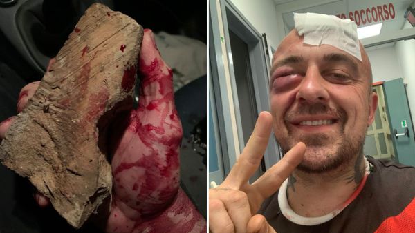 Italian chef Gabriele Rubini, commonly known as Chef Rubio, was violently attacked