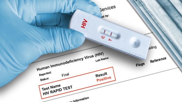 HIV