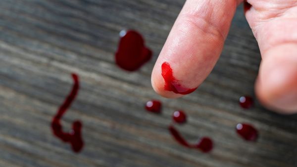 اكتشف المعنى الروحي لرؤية الدم في الحلم
