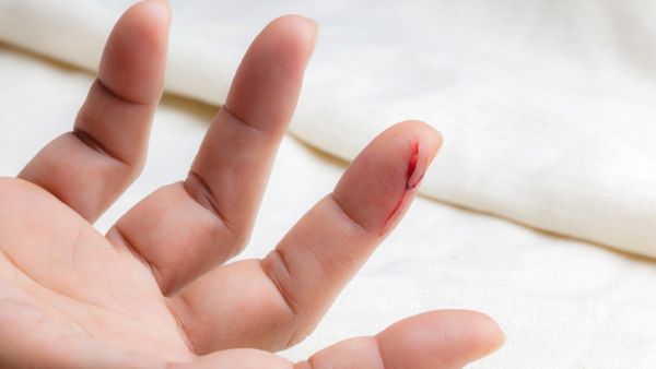 ما رمزية الحلم بقطع إصبعك في المنام؟