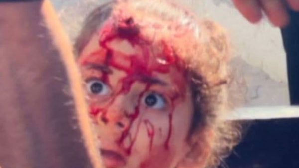 UN urges immediate action to stop Israeli genocide in Gaza 