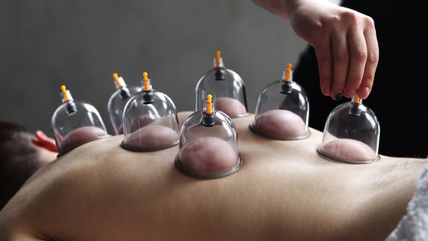 أفضل أيام الحجامة لشهر حزيران/يونيو 2026