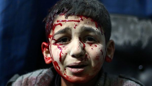 A file photo taken on February 02, 2015 shows an injured Syrian child waits for treatment at a makeshift hospital in the rebel held area of Douma, north east of the capital Damascus, following reported air strikes by forces loyal to President Bashar al-Assad. (AFP/Abd Doumany)