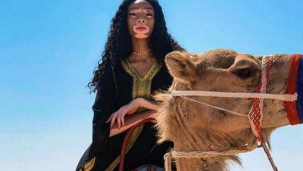 Harlow shot to fame on America’s Next Top Model in 2014 and has since worked with the who’s who of the fashion industry’s elite, including Marc Jacobs and Tommy Hilfiger. (Source: winnieharlow - Instagram)