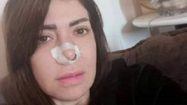 لقاء سويدان تخضع للجراجة: تجميل أم جيوب أنفية؟