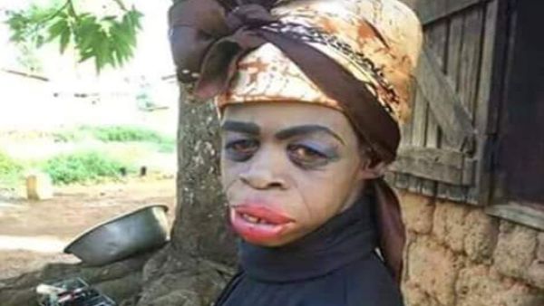 انا هنا يا ابن الحلال