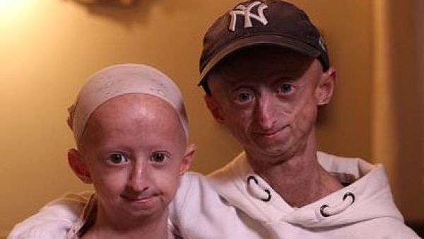 Michiel, 20, and Amber, 12, Vandeweert (Twitter)