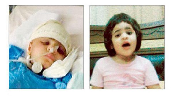 الطفلة لمى (5 سنوات) قبل وبعد التعذيب