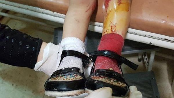 تسبَّبت تلك المجازر بحسب الشبكة باستشهاد 274 شخصاً، بينهم 117 طفلاً، و65 سيدة،