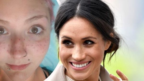 Meghan Markle fan copies royal’s famous freckles  (Twitter)