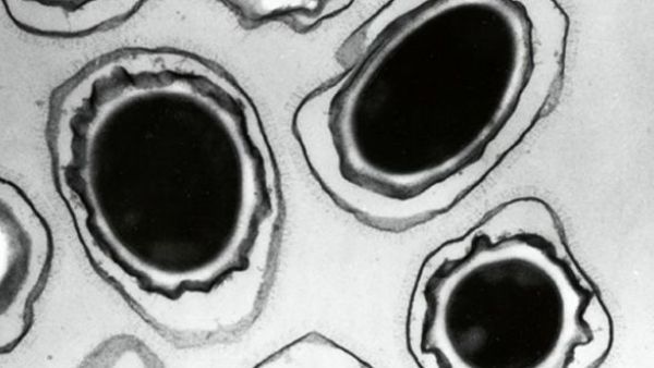 A microscopic view of anthrax spores. Photograph (AFP)