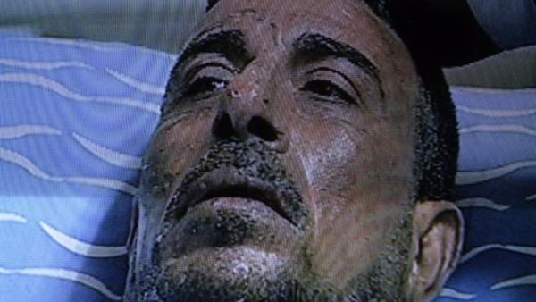 صورة للمواطن المصري الذي أحرق نفسه أمام مجلس الشعب المصري.