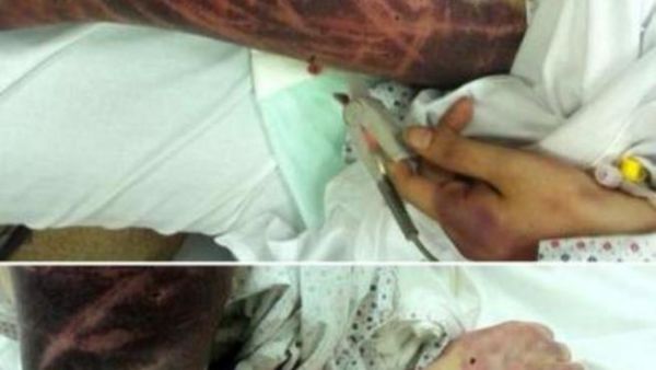 امرأة سعودية ضربها زوجها بالمفك! امرأة سعودية ضربها زوجها بالمفك!