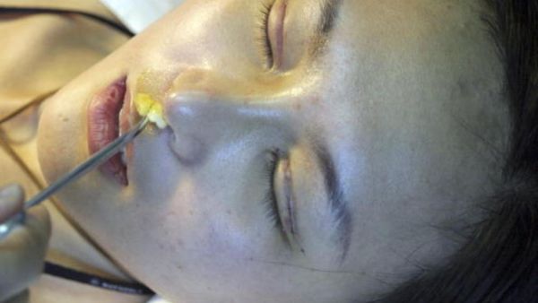 عمليات التجميل منتشرة جدا في لبنان.