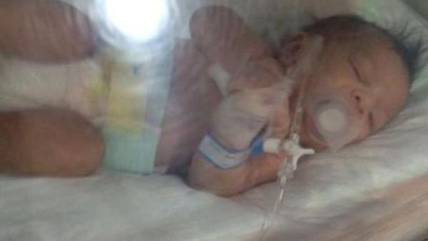 ممرضات يغلقن فم رضيع بشريط لاصق