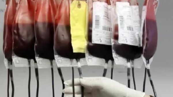 نقل دم ملوث لمواطنة سعودية يؤدي الى وفاتها