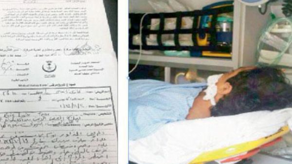 سرقة كلية مواطن سعودي في مستشفى حكومي