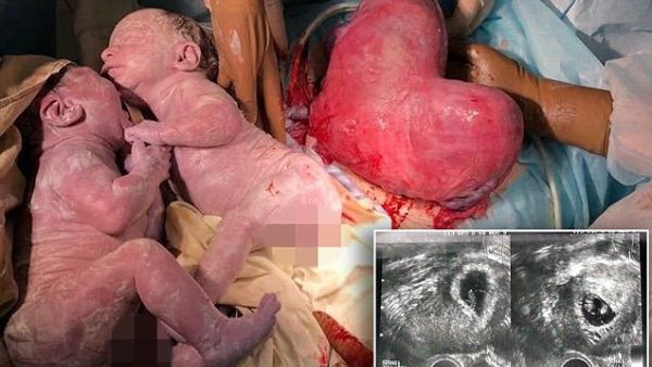 Heart-shaped womb (Twitter)