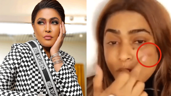 Waad was in a very bad psychological state after she discovered the results of a recent plastic surgery she had (Source: sana alsaid - Youtube - waedhanan - Instagram) Waad was in a very bad psychological state after she discovered the results of a recent plastic surgery she had (Source: sana alsaid - Youtube - waedhanan - Instagram)