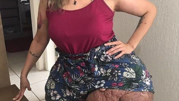 Karina Rodini with huge tumours (Twitter)