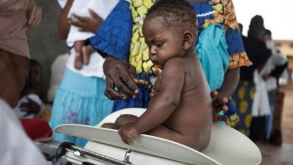 طفل على ميزان طبي في بوالي في جمهورية إفريقيا الوسطى
