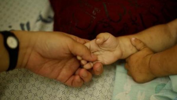 أم الطفل أحمد عباس الذي يعاني من التليف الكيسي تمسك يد ابنها في مستشفى بغزة 
