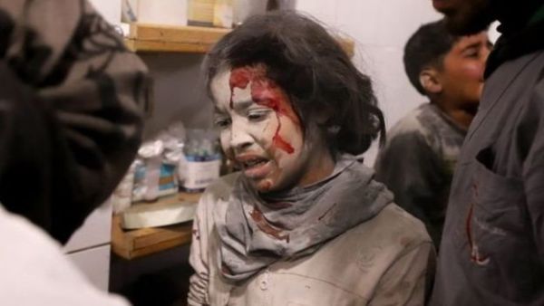 الأمم المتحدة تتوقع إجلاء مدنيين من الغوطة الثلاثاء

