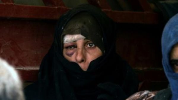 امرأة عراقية فرت من القتال الدائر بين القوات الحكومية ومن تبقى من الجهاديين في المدينة القديمة في الموصل تنتظر نقلها إلى مأوى

