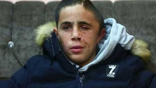 محمد التميمي