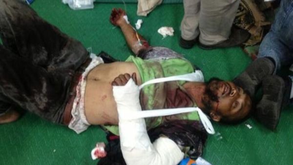 سقوط 40 قتيلا وأكثر من 500 مصاب إثر إطلاق قوات الجيش والشرطة الرصاص الحي على المعتصمين المؤيدين لمرسي