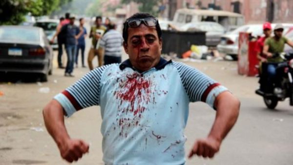 متظاهر مصري اصيب بجروح في مواجهات بين انصار الرئيس معارضيه في القاهرة/أ.ف.ب