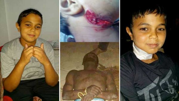 انتشار مخدر “الفلاكا” المعروف بـ”الزومبى” فى مصر