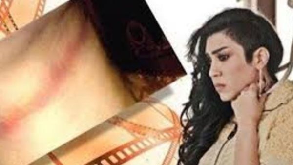 Fatima Abdel Rehim is alive to act another day after brush with death