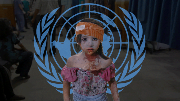 A Syrian girl, wounded after bombings in her neighborhood of Eastern Ghouta (Rami Khoury/Al Bawaba)