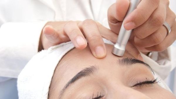 التقشير بالالماس