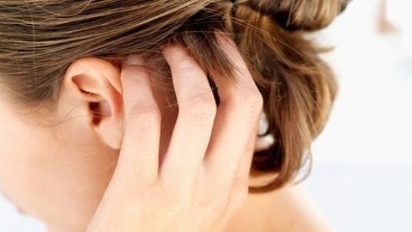 يجب معرفة أن لتساقط الشعر عدة أسباب 