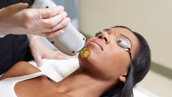 العلاج بالليزر يساعد على التخلص من البثور